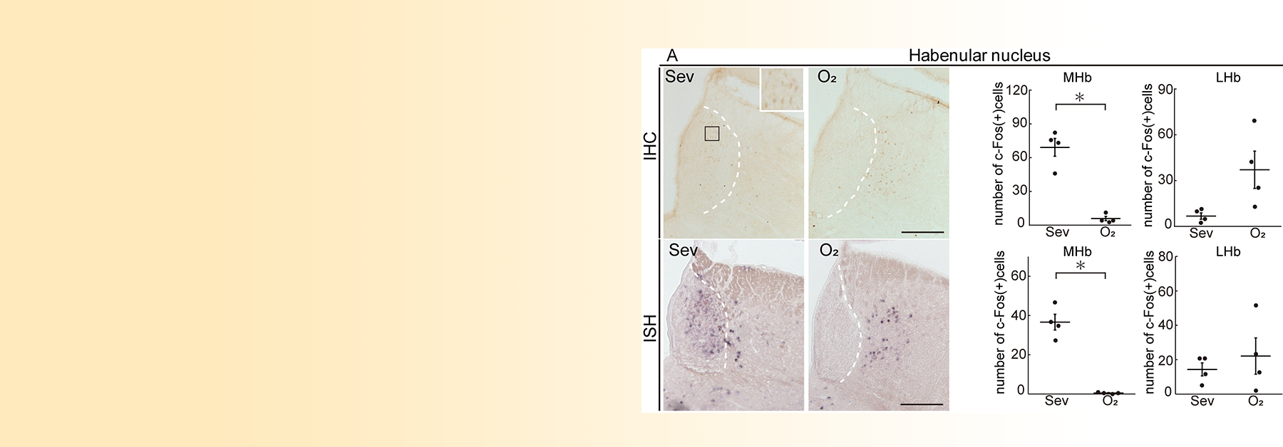 Metabolic Reprogramming Drives Pituitary Tumor Growth through Epigenetic Regulation of TERT